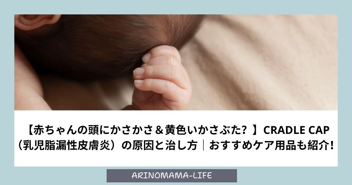 【赤ちゃんの頭にかさかさ＆黄色いかさぶた？】cradle cap （乳児脂漏性皮膚炎）の原因と治し方｜おすすめケア用品も紹介！